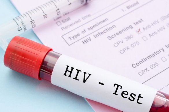 Тест на ВИЧ в рамках диспансеризации